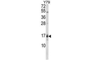 Western blot analysis of GADD45A Antibody (C-term) in Y79 cell line lysates (35ug/lane). (GADD45A anticorps  (C-Term))
