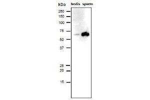 Western Blotting (WB) image for anti-Izumo Sperm-Egg Fusion 1 (IZUMO1) antibody (ABIN2452040) (IZUMO1 anticorps)