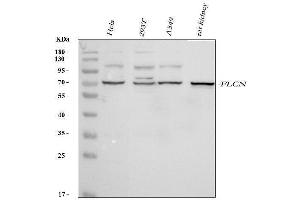Western blot analysis of FLCN using anti-FLCN antibody (ABIN7602491). (FLCN anticorps  (AA 8-551))