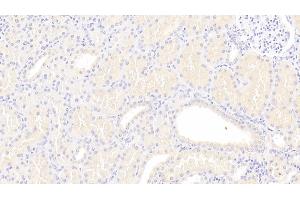 Detection of Lpa in Human Kidney Tissue using Polyclonal Antibody to Lipoprotein, a (Lpa) (LPA anticorps  (AA 1719-2038))