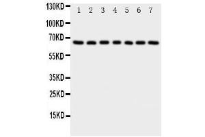 Western Blotting (WB) image for anti-NADPH Oxidase 4 (NOX4) (AA 561-578), (C-Term) antibody (ABIN3044011) (NADPH Oxidase 4 anticorps  (C-Term))