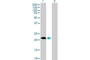 Western Blot analysis of PAGE4 expression in transfected 293T cell line by PAGE4 MaxPab polyclonal antibody. (PAGE4 anticorps  (AA 1-102))