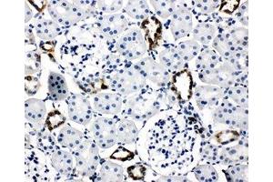 IHC-P: AQP2 antibody testing of rat kidney tissue (AQP2 anticorps  (AA 245-260))