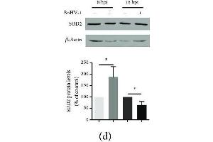 The effects of BoHV-1 infection on the gene expression of antioxidant enzymes.