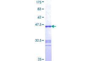 Image no. 1 for ATP/GTP Binding Protein 1 (AGTPBP1) (AA 1087-1186) protein (GST tag) (ABIN1344606)