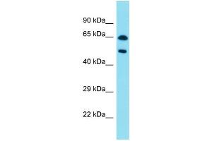 Host:  Rabbit  Target Name:  PAX8  Sample Type:  Pancreas Tumor lysates  Antibody Dilution:  1. (PAX8 anticorps  (C-Term))