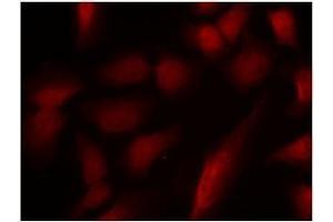 Image no. 1 for anti-GATA Binding Protein 1 (Globin Transcription Factor 1) (GATA1) (pSer310) antibody (ABIN196686) (GATA1 anticorps  (pSer310))