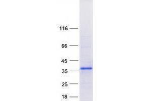 Validation with Western Blot