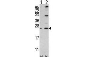 Western Blotting (WB) image for anti-BCL2-Like 2 (BCL2L2) (BH3 Domain) antibody (ABIN2997114)