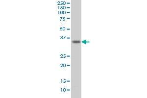 SPRY1 monoclonal antibody (M01), clone 3H4 Western Blot analysis of SPRY1 expression in HepG2 .