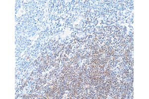 Immunohistochemistry (IHC) image for anti-CD28 (CD28) (AA 19-140) antibody (ABIN7448899) (Recombinant CD28 anticorps  (AA 19-140))