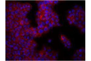 Immunofluorescence (IF) image for anti-Integrin beta 1 (ITGB1) antibody (ABIN2664519) (ITGB1 anticorps)