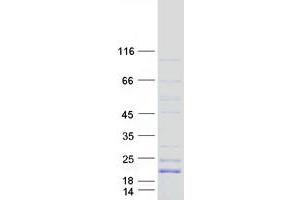Validation with Western Blot (CD42a Protein (Myc-DYKDDDDK Tag))