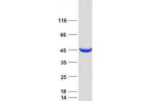 Validation with Western Blot