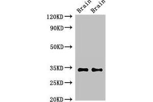 Western Blot Positive WB detected in: Mouse brain tissue, Rat brain tissue All lanes: NPY6R antibody at 2.