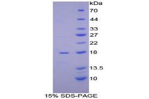 SDS-PAGE analysis of Human aHSP Protein. (aHSP Protéine)