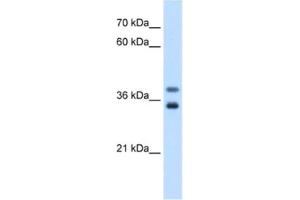 Western Blotting (WB) image for anti-Glycerophosphodiester Phosphodiesterase 1 (GDE1) antibody (ABIN2463055) (GDE1 anticorps)