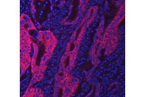 IF analysis of SWAP70 using anti-SWAP70 antibody (ABIN7600201).