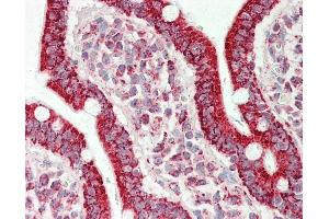 Anti-ATP5A1 / ATP Synthase Alpha antibody IHC staining of human small intestine.
