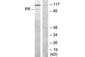 Western blot analysis of extracts from COS7 cells, treated with EGF, using Progesterone Receptor (Ab-190) Antibody. (Progesterone Receptor anticorps  (AA 161-210))