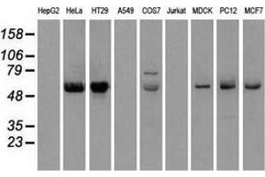Western blot analysis of extracts (35 µg) from 9 different cell lines by using anti-CHEK2 monoclonal antibody. (CHEK2 anticorps)