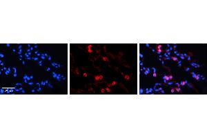 TKT antibody - N-terminal region          Formalin Fixed Paraffin Embedded Tissue:  Human Lung Tissue    Observed Staining:  Cytoplasm of pneumocytes   Primary Antibody Concentration:  1:100    Secondary Antibody:  Donkey anti-Rabbit-Cy3    Secondary Antibody Concentration:  1:200    Magnification:  20X    Exposure Time:  0.