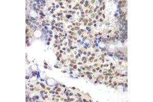 Immunohistochemistry of paraffin-embedded rat Intestine using U2 antibody (ABIN6130748, ABIN6149754, ABIN6214722 and ABIN6214724) at dilution of 1:200 (40x lens). (U2AF1 anticorps  (AA 1-240))