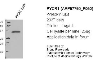 Image no. 1 for anti-Pyrroline-5-Carboxylate Reductase 1 (PYCR1) (Middle Region) antibody (ABIN2787369)