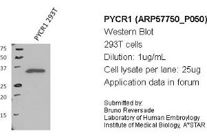 Image no. 1 for anti-Pyrroline-5-Carboxylate Reductase 1 (PYCR1) (Middle Region) antibody (ABIN2787369) (PYCR1 anticorps  (Middle Region))