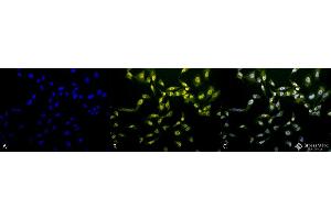 Immunocytochemistry/Immunofluorescence analysis using Rabbit Anti-Phosphothreonine Polyclonal Antibody . (Phosphothreonine anticorps  (FITC))
