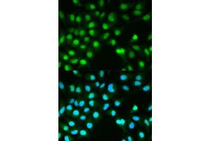 Immunofluorescence analysis of HeLa cell using PPP3CA antibody. (PPP3CA anticorps  (AA 1-511))