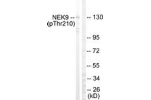 Western blot analysis of extracts from HepG2 cells, using NEK9 (Phospho-Thr210) Antibody. (NEK9 anticorps  (pThr210))