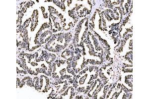 IHC analysis of PIWIL4/PIWI using anti-PIWIL4/PIWI antibody (ABIN7601940).