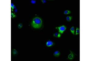 Immunofluorescence staining of MCF-7 cells with ABIN7164878 at 1:66, counter-stained with DAPI. (PRSS8 anticorps  (AA 185-319))