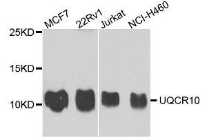 Western blot analysis of extracts of various cell lines, using UQCR10 antibody. (UQCR10 anticorps  (AA 1-63))