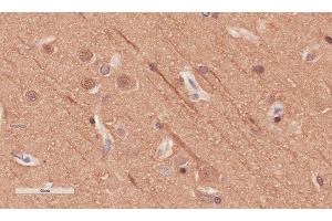 Immunohistochemical staining of human cerebral cortex tissue using anti-Alpha Tubulin antibody.
