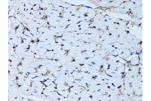Immunohistochemistry of paraffin-embedded mouse heart using FABP4 antibody.