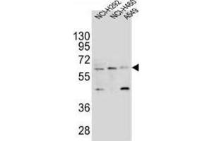 Western Blotting (WB) image for anti-Leukocyte Immunoglobulin-Like Receptor, Subfamily A (With TM Domain), Member 2 (LILRA2) antibody (ABIN2995659) (LILRA2 anticorps)