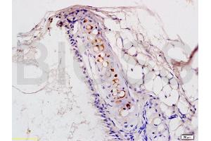 Formalin-fixed and rat lung tissue labeled with Anti-PTAFR Polyclonal Antibody, Unconjugated (ABIN687127) at 1:200 followed by conjugation to the secondary antibody and DAB staining