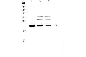 Western blot analysis of CBFb using anti-CBFb antibody . (CBFB anticorps  (AA 1-182))