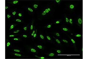 Immunofluorescence of monoclonal antibody to OXSR1 on HeLa cell. (OXSR1 anticorps  (AA 351-450))