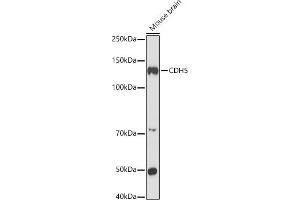 Western blot analysis of extracts of Mouse brain, using CDH5 antibody (ABIN6134029, ABIN6138297, ABIN6138298 and ABIN6216033) at 1:1000 dilution. (Cadherin 5 anticorps  (AA 650-750))