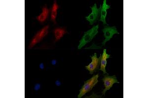 ABIN7094611 and ABIN7098661 staining  cells by IF/ICC. (ANTXR1 anticorps  (Internal Region))