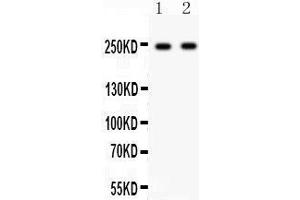 Western Blotting (WB) image for anti-Calcium Channel, Voltage-Dependent, L Type, alpha 1D Subunit (CACNA1D) (AA 1-180) antibody (ABIN3043768) (CACNA1D anticorps  (AA 1-180))
