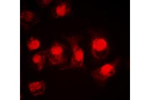 Immunofluorescent analysis of MSK1 staining in HEK293T cells. (MSK1 anticorps  (Center))