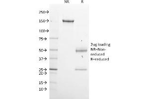 SDS-PAGE Analysis Purified GPN1 Mouse Monoclonal Antibody (GPN1/2350).