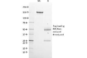 SDS-PAGE Analysis Purified GPN1 Mouse Monoclonal Antibody (GPN1/2350). (GPN1 anticorps)