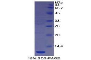 SDS-PAGE analysis of Human PECAM1 Protein. (CD31 Protéine)