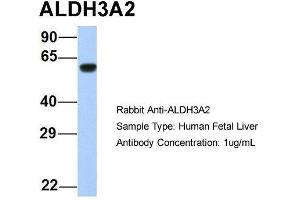Host:  Rabbit  Target Name:  ALDH3A2  Sample Type:  Human Fetal Liver  Antibody Dilution:  1. (ALDH3A2 anticorps  (Middle Region))