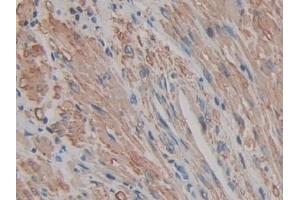 Detection of ACTg2 in Human Prostate Tissue using Polyclonal Antibody to Actin Gamma 2, Smooth Muscle (ACTg2)